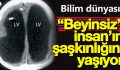 BEYİNSİZ İNSAN BULUNDU,ÜSTELİK MEMUR