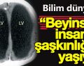 BEYİNSİZ İNSAN BULUNDU,ÜSTELİK MEMUR