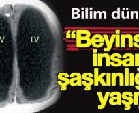 BEYİNSİZ İNSAN BULUNDU,ÜSTELİK MEMUR